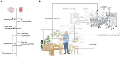 Pre-hospital stroke monitoring past, present, and future: a perspective